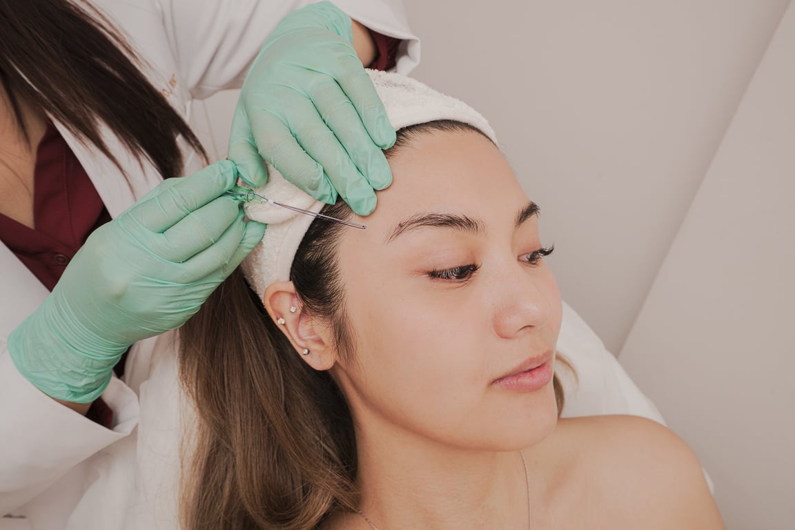 Beyond the Knife: PDO Thread Lifts at Mold Manila for a Natural, Summer-Ready Lift